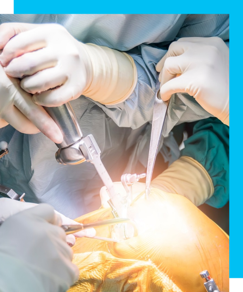 Medical experts performing a joint-replacement surgery.